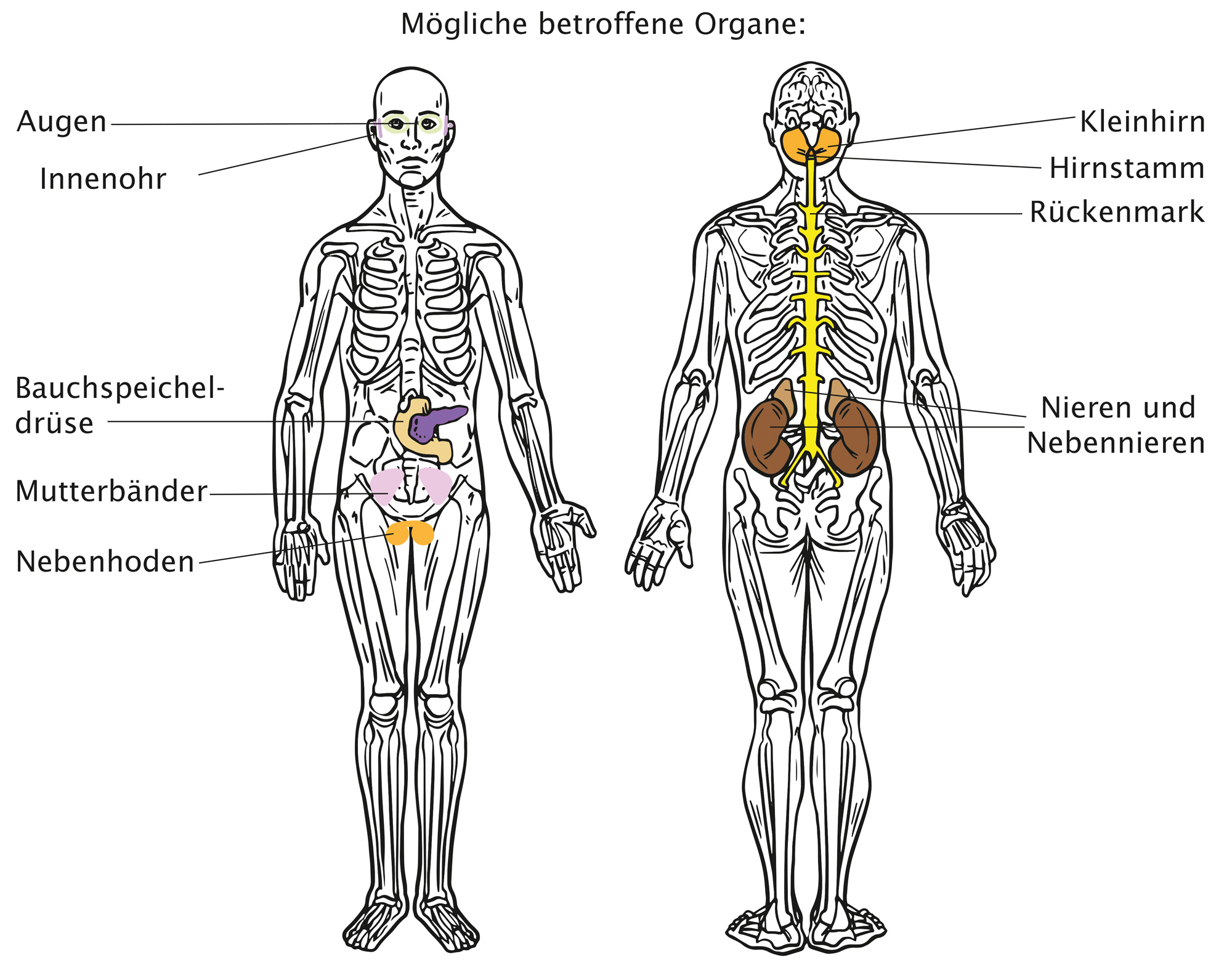 Illustration-der-betroffenen-Organe Illustration der betroffenen Organe